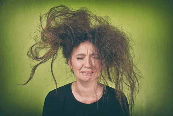 Com síndrome rara, garotinha chama atenção pelo cabelo