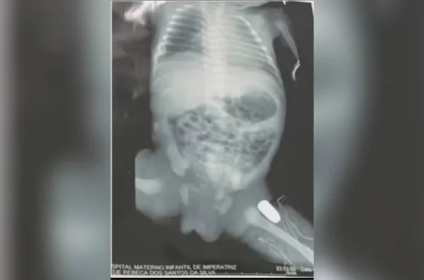 imagem colorida bebe atingido tiro na barriga da mae