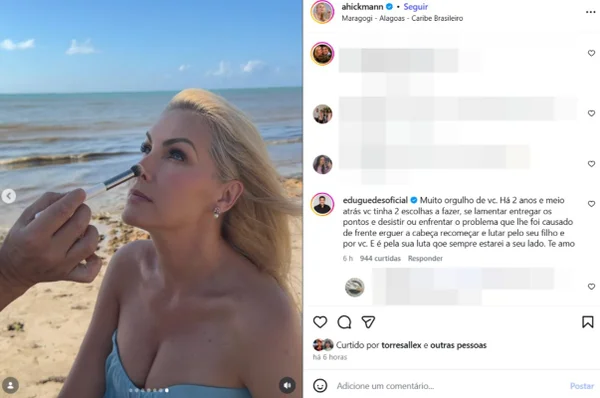 Edu Guedes relembra dificuldades e se declara a Ana Hickmann: “Orgulho” - destaque galeria Edu Guedes relembra dificuldades e se declara a Ana Hickmann: “Orgulho” - destaque galeria