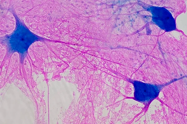 fotografia de neurônios em rosa e azul