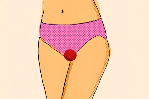 Ilustração mostra mulher de calcinha com uma mancha de sangue - Ginecologistas listam as 6 principais razões de atraso na menstruação/ ciclo menstrual - Metrópoles