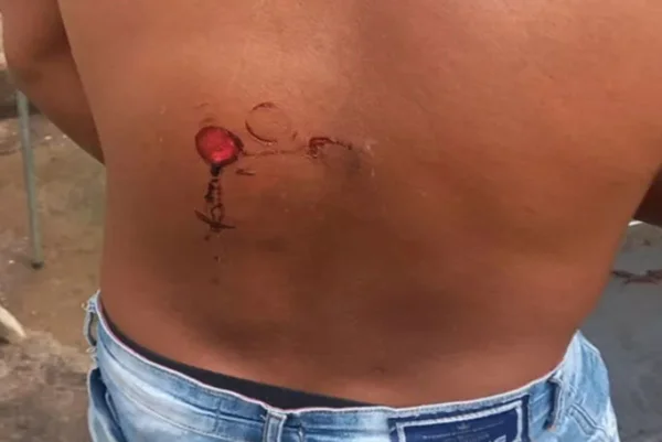 Torcedor é atingido por tiro de bala de borracha, em Mozarlândia, Goiás