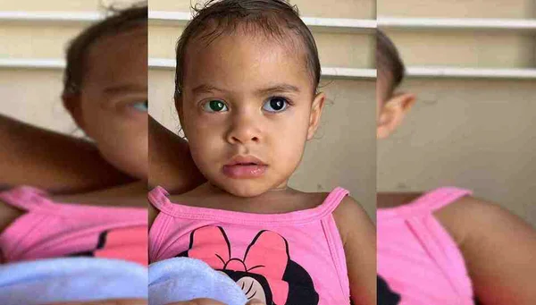 Sofia abre olho pela 1ª vez após acidente com Super Bonder: “Alívio”