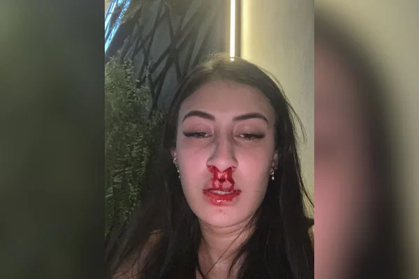 Gabriela diz que levou um soco no rosto e desmaiou