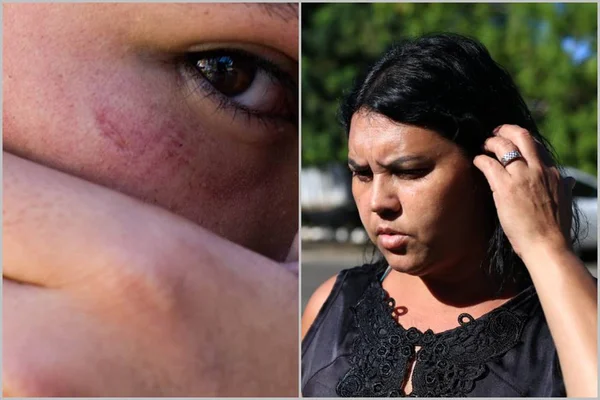 Mãe e adolescente espancado após assobio, no DF