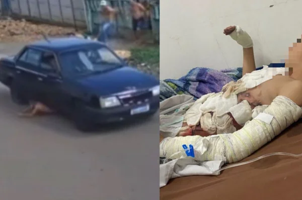 Uma criança foi atropelada e arrastada por vários metros na tarde desse sábado (6/12), no bairro Jardim das Américas, em Guarapuava (MT)