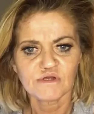 Atriz que teve rosto corroído por cocaína aparece irreconhecível. Veja - destaque galeria Atriz que teve rosto corroído por cocaína aparece irreconhecível. Veja - destaque galeria