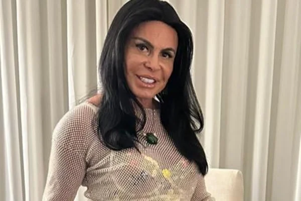 Transplante de Gretchen por alopecia: médicos explicam queda de cabelo - Metrópoles