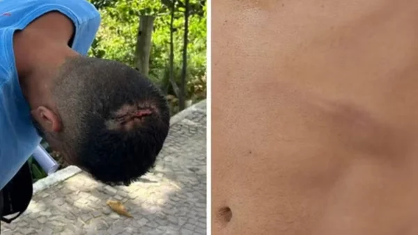 imagem colorida turista denuncia agressao quiosque vila velha