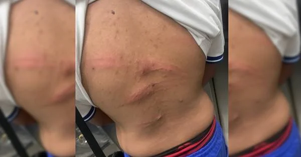 Filho agredido pelos pais