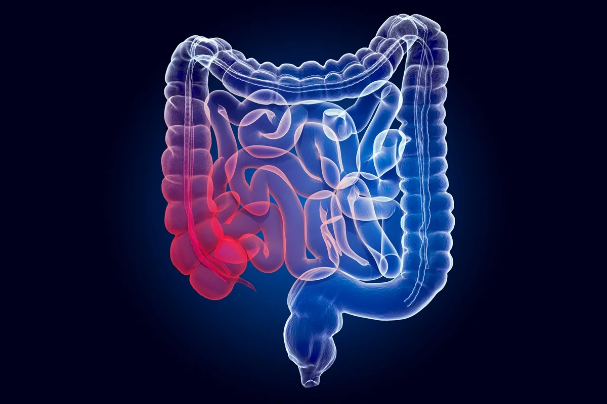 Coloproctologista aponta o que fazer para manter o cólon saudável
