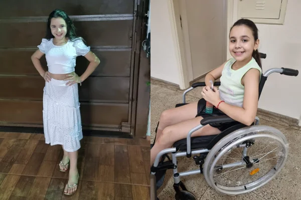 Tratamento contra a hanseníase faz menina de 11 anos voltar a andar