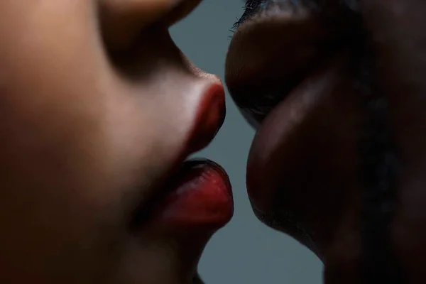 Beijo - Metrópoles