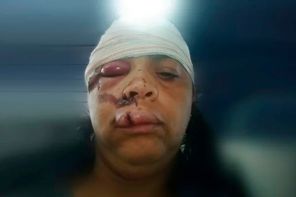 Mulher tem rosto arrastado no chão durante roubo em São Paulo