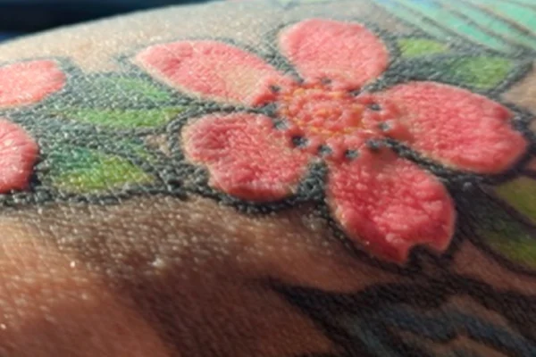 Tatuagem vermelha alergia polonês