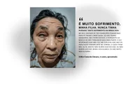 Relato de dona Edilce, paciente do Mais Visão. Ela fez a extração do olho na quinta-feira da semana passada