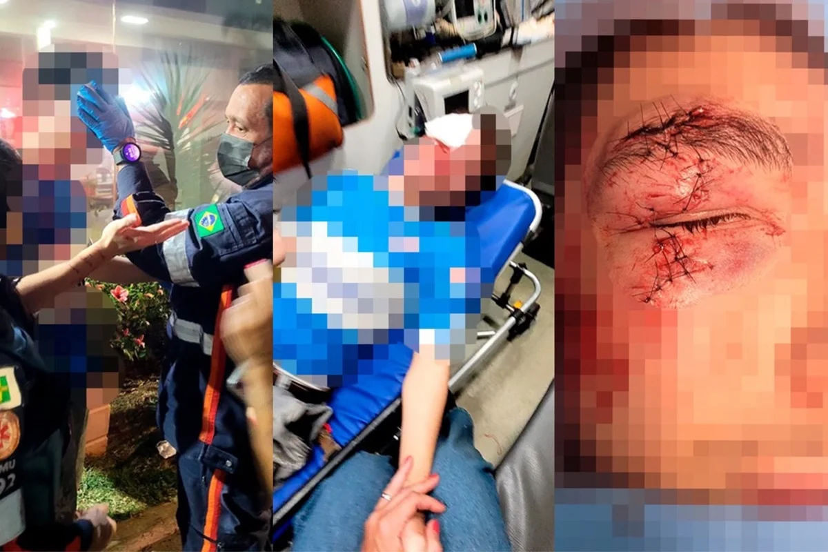 Agressão em Águas Claras: Jovem tem rosto desfigurado; Sospeito Solto
