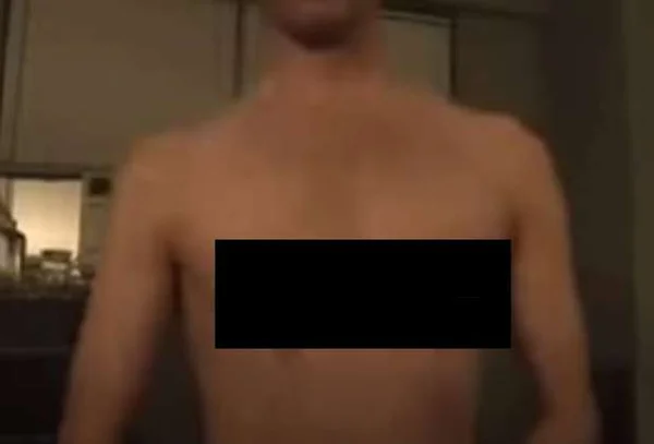 Homem perdeu os dois mamilos