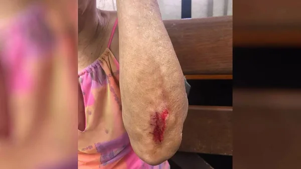 Idosa é agredida com facas e tesoura pelo próprio filho em Goiás