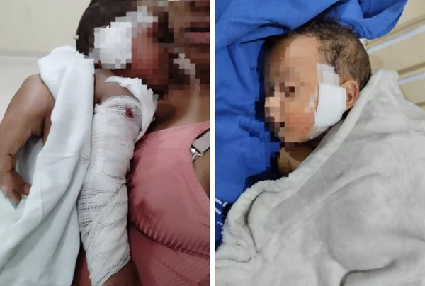 Fotografia do bebê acidentado, nos braços da mãe