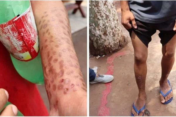 Foto colorida de pacientes em clínica de reabilitação em Mato Grosso do Sul - Metrópoles