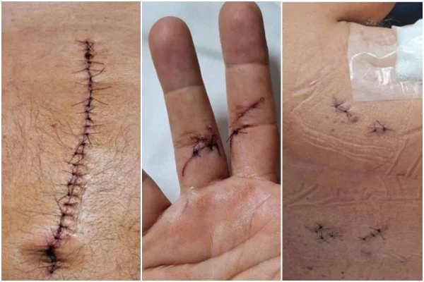 Veja lesões de major esfaqueado em trânsito por sargento que foi solto