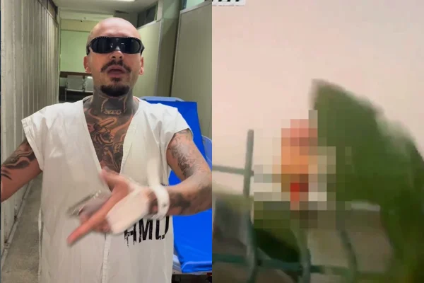 Streamer perde dedo durante live - Metrópoles