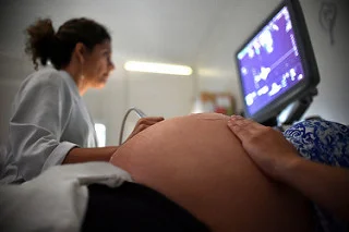 Grávidas são prioridade para fazer exame de zika vírus