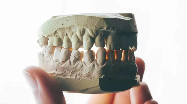Arcada dentária dente boca dentista