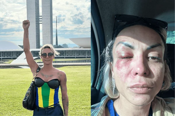 Ativista trans relata agressão em SP: "tentativa de transfeminicídio"