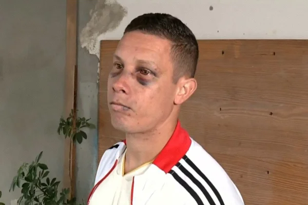 Imagem colorida, Motorista de app é sequestrado, espancado e torturado por criminosos no Rio-Metrópoles