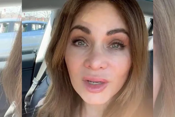 Mulher mostra o rosto natural após 20 anos de botox: “Parei de usar”