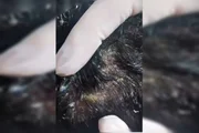 Outra foto da lesão cabeça de uma das crianças Outra foto da lesão cabeça de uma das crianças