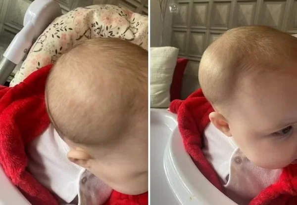 Mãe descobre fratura no crânio da filha ao buscá-la em creche - Rascunhos