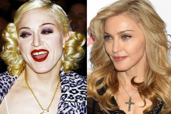Madonna pede desculpas após ter mandado Trump “chupar pau”