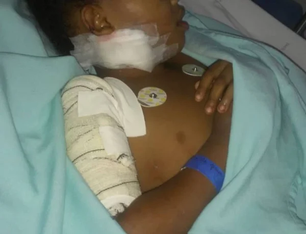 Menina de 6 anos tem braço reconstruído após ataque de pit bull