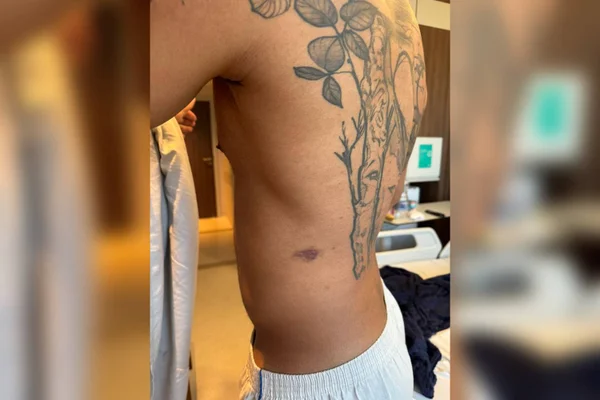 Imagem colorida de um homem com o corpo machucado - Metrópoles