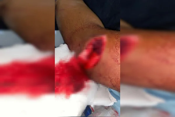 Homem é preso após tentar decepar cabeça de rival em briga