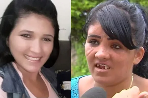 Mulher é espancada ao tentar pegar o filho com ex-companheiro