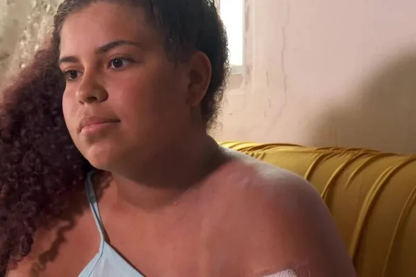 Foto colorida de Kaylanne Timóteo Freitas que perdeu parte do braço após ataque de tubarão - Metrópoles
