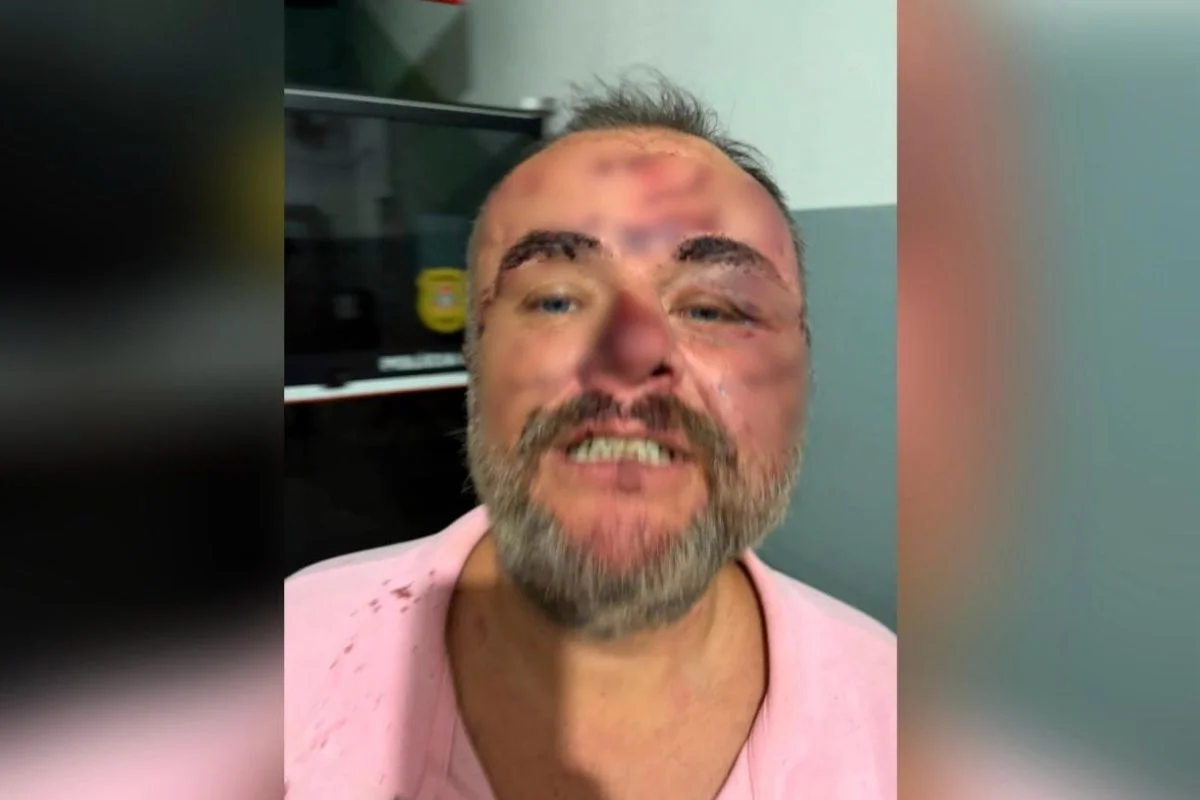 Advogado diz ter sido agredido por policiais militares durante ocorrência em Ribeirão Preto Advogado diz ter sido agredido por policiais militares durante ocorrência em Ribeirão Preto