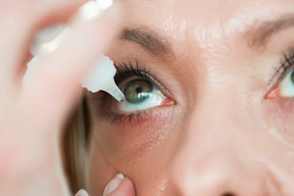 Foto colorida de uma mulher aplicando colírio nos olhos - Metrópoles.
