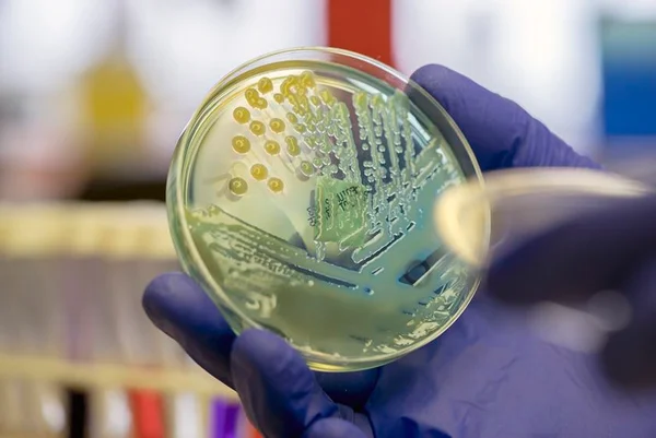 Mucoid colonies of the pathogenic multi-drug resistant Klebsiella pneumoniae on CLED agar plate. This particular strain of coliform bacteria isolated in the laboratory is positive for both the ESBL and Carbapenemase gene.