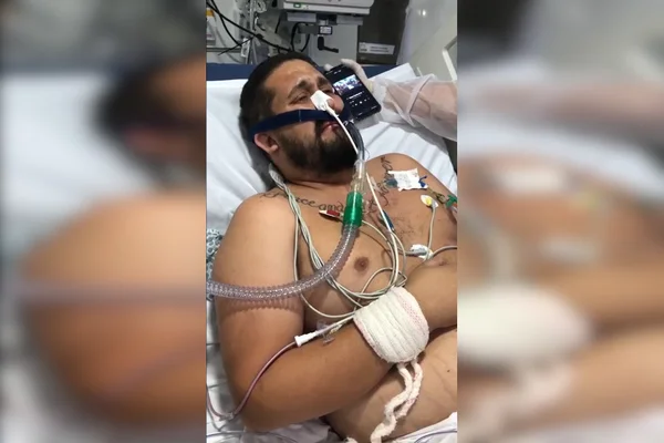Vídeo emocionante: após 18 dias intubado, homem é extubado ao som do Menos é Mais
