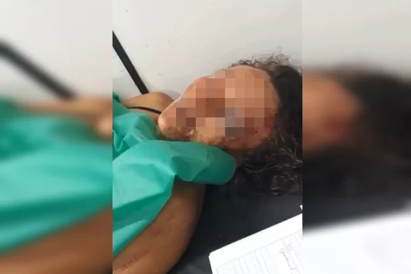 Marido é acusado de bater cabeça da mulher contra a parede no DF