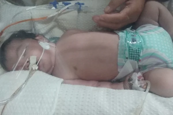 Drama no HRP: não há vaga na UTI para recém-nascida com edema pulmonar