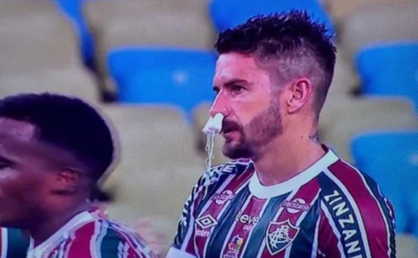 Imagem colorida de Everaldo, do Fluminense- Metrópoles