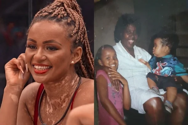 Mãe de Natália, do BBB22, diz que o reality piorou o vitiligo da filha