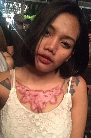 Garota relata momentos de dor ao remover tatuagem com método polêmico - imagem 16 Garota relata momentos de dor ao remover tatuagem com método polêmico - imagem 16
