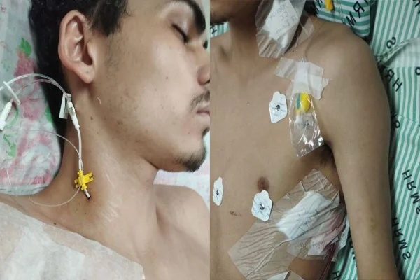 Imagem coloridad e jovem que desenvolvou sequelas por uso de Pod - Metrópoles